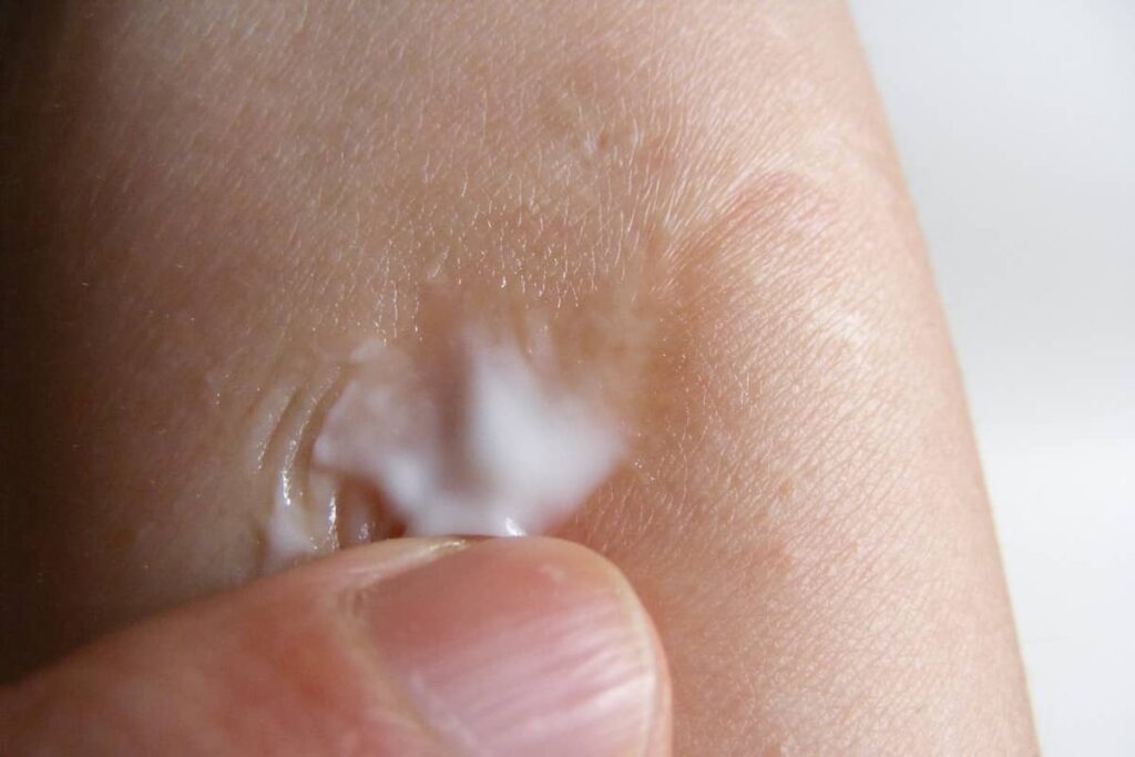 Pantenol krema za lice intenzivno hidrira i obnavlja kožu
